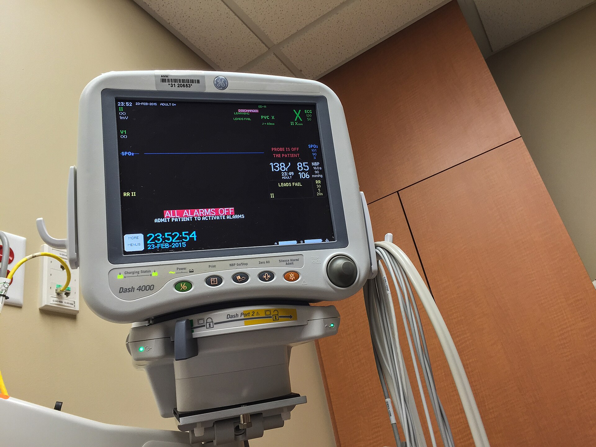 A bedside patient monitor screen showing colored waveform lines and numeric vital sign readings, mounted on a hospital wall